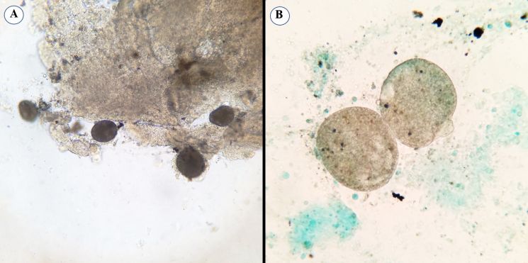 Cryptocaryon irritans visto en microscopio